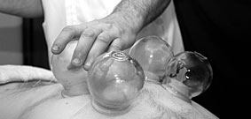 Cupping and Moxibustion Therapy